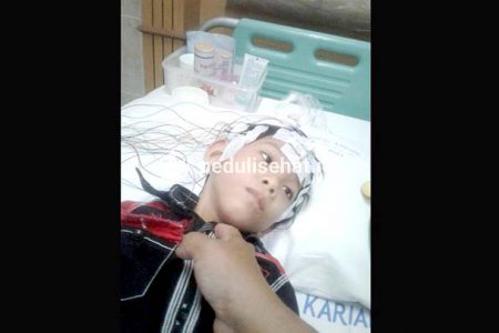 Derita Kelainan Otak Sejak Lahir, Zakiy Butuh Uluran Tangan