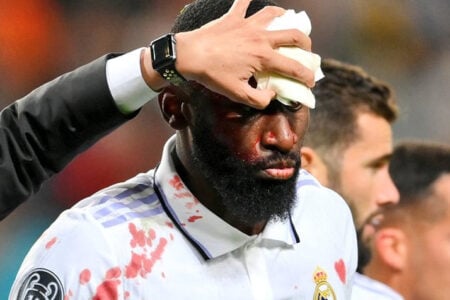 Antonio Rudiger Terima 20 Jahitan di Jidatnya